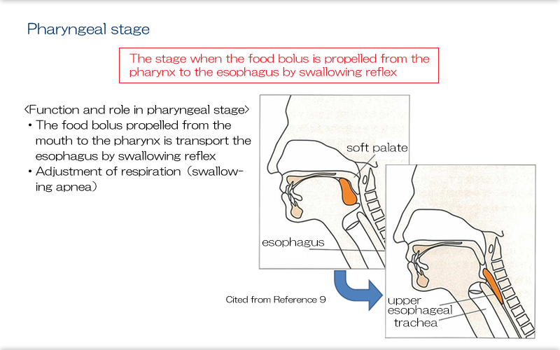 6.Disorders of Each Stage of Swallowing