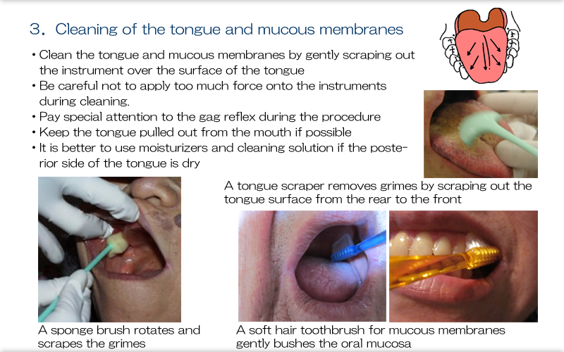 mucous membranes