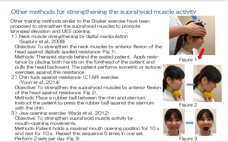 47.Indirect Training for the Pharyngeal Stage UsingThermal Tactile